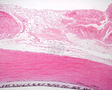 Foto de Microscopio de luz de muy bajo aumento que muestra, desde la parte superior, dos fascículos de músculos extraoculares, el tejido conjuntivo suelto de episclera, el tejido conectivo denso de esclerótica, la lámina fusca pigmentada y la ch vascular y pigmentada - Imagen libre de derechos