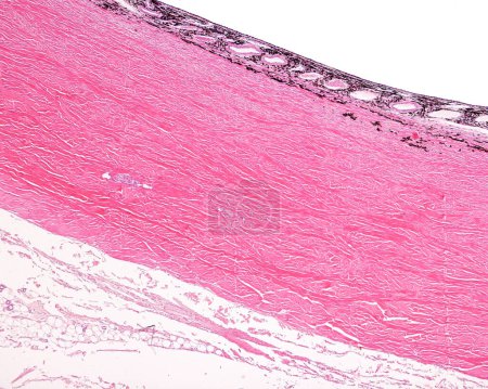 Foto de Micrografía ligera de la pared del globo ocular que muestra, de abajo hacia arriba, la episclera, la esclerótica, la lámina fusca pigmentada y la coroides vascular y pigmentada del ojo. - Imagen libre de derechos