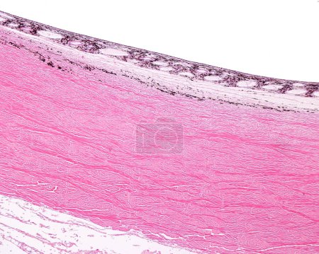 Foto de Micrografía ligera de la pared del globo ocular que muestra, de abajo hacia arriba, la episclera, la esclerótica, la lámina fusca pigmentada y la coroides vascular y pigmentada del ojo. - Imagen libre de derechos