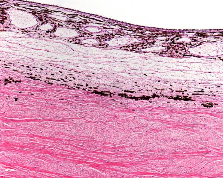 Foto de Microscopio de luz que muestra el límite entre la esclerótica (inferior) y la coroides (superior). La capa interna de la esclerótica tiene células pigmentadas (lámina fusca o lámina suprachoroide). - Imagen libre de derechos