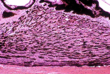 Photo for Cross sectioned ciliary body, resting on the sclera (bottom), showing the typical triangular shape due to ciliary muscle. The smooth muscle fibers of ciliary muscle are surrounded by a stroma with many pigmented cells. On top border, the pigmented ep - Royalty Free Image