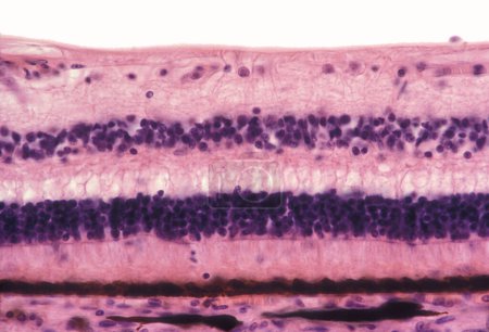 Photo for Light micrograph of a human retina. From top to bottom, the retina layers are: nerve fibre layer, ganglion cell layer, inner plexiform layer, inner nuclear layer, outer plexiform layer, outer nuclear layer, rods and cones layer, and pigment epitheliu - Royalty Free Image