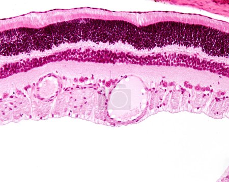 Couches de rétine, micrographie photonique. De haut en bas : épithélium pigmentaire, tiges et cônes, noyau externe, plexiforme externe, noyau interne, plexiforme interne, cellules ganglionnaires et couches de fibres nerveuses. Une artère dilatée et une veine apparaissent dans la cellule ganglionnaire la