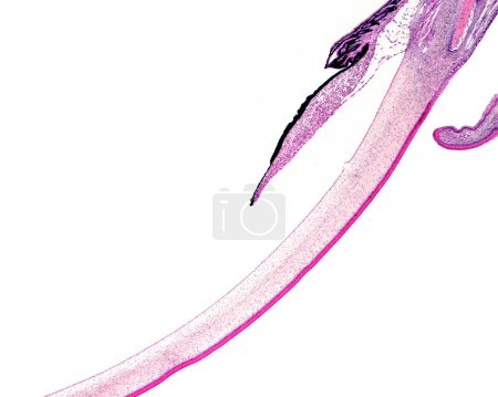 Foto de Micrografía de muy bajo aumento del polo anterior de un globo ocular de ave. Desde arriba, se pueden reconocer las siguientes estructuras: córnea, con conjuntiva en ambos bordes laterales (note el cambio en la tinción del estroma), iris (con pigmento principalmente en po - Imagen libre de derechos