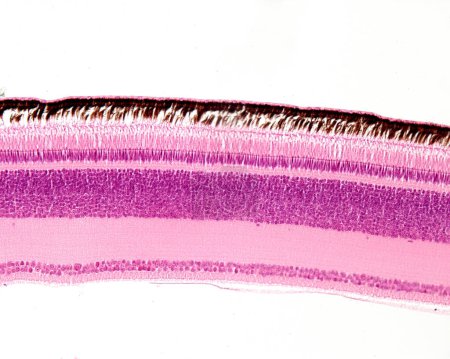 Photo for Light microscope micrograph showing the layers of a bird's retina. From top to bottom, the retina layers are: pigment epithelium layer, rods and cones layer, outer nuclear layer, outer plexiform layer, inner nuclear layer, inner plexiform layer, gang - Royalty Free Image