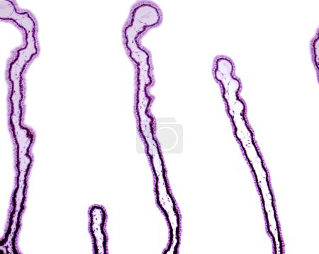 Foto de Cuerpo ciliar. Procesos ciliares aislados que muestran claramente la doble capa epitelial, el epitelio interno no pigmentado y el epitelio pigmentado. - Imagen libre de derechos