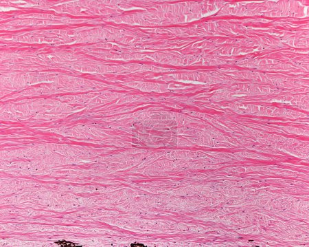 Foto de Microscopio de luz que muestra la esclerótica, un tejido conectivo denso con abundantes fibras de colágeno. En la parte inferior, la capa interna de la esclerótica tiene algunas células pigmentadas. Es la lámina fusca o lámina suprachoroide. - Imagen libre de derechos
