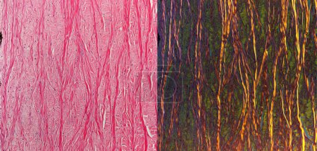 Foto de Micrografías comparativas de luz de la esclerótica ocular teñida con hematoxilina y eosina (H & E, izquierda) y vista bajo luz polarizada (derecha). Bajo luz polarizada, los fascículos de fibras de colágeno seccionadas longitudinalmente parecen brillantes. Collaf de sección transversal - Imagen libre de derechos