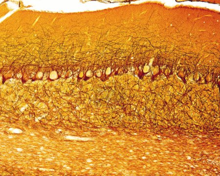 Téléchargez les photos : Micrographie à faible grossissement d'une rate de rat colorée avec la technique histochimique de détection de la phosphatase acide. Avec cette technique, les macrophages sont colorés en brun. Il y a une forte concentration de macrophages dans la pulpe rouge, alors que le sont - en image libre de droit