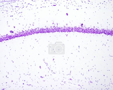 Micrographie à faible grossissement d'une rate de rat colorée avec la technique histochimique de détection de la phosphatase acide. Avec cette technique, les macrophages sont colorés en brun. Il y a une forte concentration de macrophages dans la pulpe rouge, alors que le sont