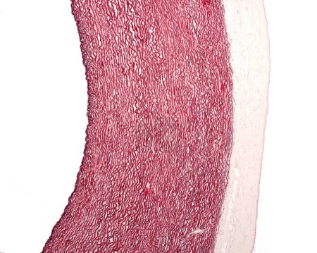 Micrographie à faible grossissement d'une rate de rat colorée avec la technique histochimique de détection de la phosphatase acide. Avec cette technique, les macrophages sont colorés en brun. Il y a une forte concentration de macrophages dans la pulpe rouge, alors que le sont