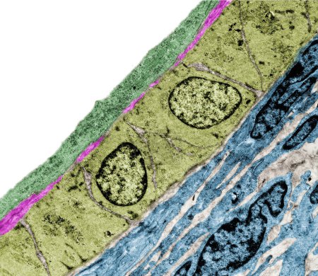 Coloured transmission electron micrograph (TEM) of a small arteriole showing, from lumen: endothelium (magenta), discontinuous internal elastic lamina (blue), cross-sectioned smooth muscle fibers (cytoplasm, red, nucleus, light yellow) and connective