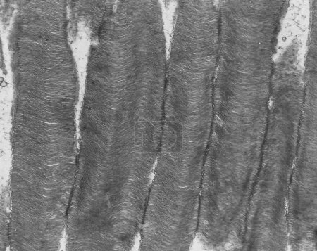 Transmission electron micrograph (TEM) showing the photoreceptor outer segments of retinal rod cells, full of stacked membranous discs filled with opsin, the molecule that absorbs photons.