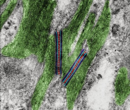 Farbige Transmissionselektronenmikroskopie (TEM), die zwei Desmosomen (Makulaadherene) mit prominenten Cadherin-dichten Plaques (blau) zeigt, an denen Keratin-Zwischenfilamente (hellgrün) angebracht waren. Der interzelluläre Raum zeigt dunkle Brücken (rot) von