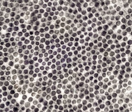 Transmission electron micrograph (TEM) of connective tissue showing cross-sectioned collagen microfibrils.
