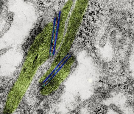 Coloured transmission electron micrograph (TEM) showing two desmosomes (maculae adherens) with prominent cadherin dense plaques (blue) where keratin intermediate filaments (light green) were attached. The intercellular space shows dark bridges (red) 