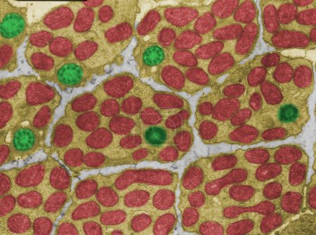 Coloured transmission electron micrograph (TEM) of cross-sectioned inner segments (ellipsoid) of photoreceptors. The region contains many mitochondria (red) and a cilium (green) that connects with the outer segment.