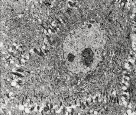 Epidermis. Elektronenmikroskopische Mikrographie, die eine Keratinozyte der Dornschicht zeigt. Die Epithelzelle hat eine polygonale Form, einen zentralen Kern mit Kern, ein Zytoplasma voller Keratin-Filamentbündel und zahlreiche dunkle Desmosomen, die das Intermezzo durchqueren.