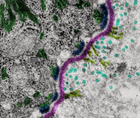 Micrographie électronique à transmission colorée (TEM) de la surface basale d'une cellule épithéliale pavimenteuse stratifiée montrant des faisceaux de filaments intermédiaires de kératine (vert) et d'hémidesmosomes (bleu) se joignant à la membrane basale (rose). Sur le connectif t