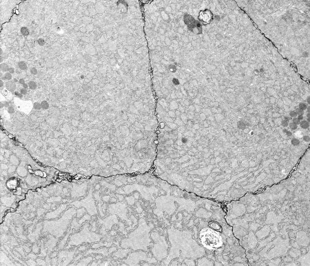 Photo for The narrow intercellular space between epithelial cells can be filled with electron dense markers such as lanthanum nitrate. This electron-dense cation, which binds avidly to calcium binding sites, can be used as tracer for delineating extracellular - Royalty Free Image