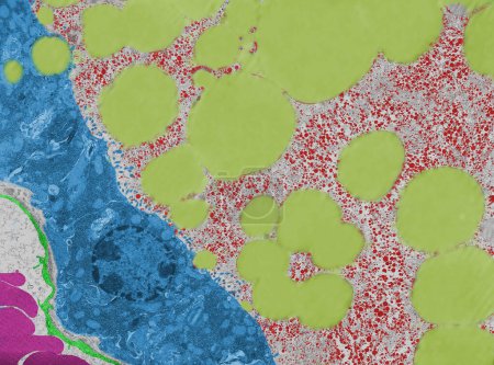 Micrographie électronique à transmission colorée (TEM) d'une glande mammaire en lactation. Après sécrétion, l'épithélium alvéolaire (bleu) reste plus bas. La sécrétion de lait de la lumière alvéolaire montre des gouttelettes lipidiques (jaune clair) et des particules de glycogène (rouge). A b