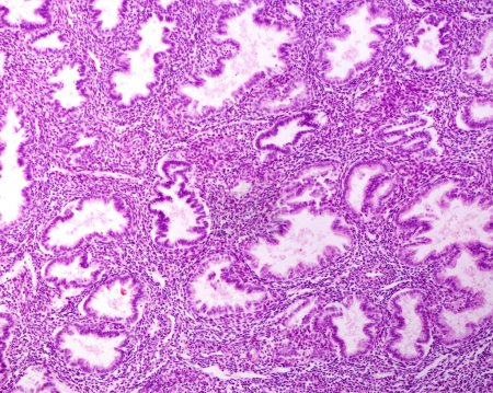 Endometrial glands in secretory phase, light micrograph. During the secretory phase of the uterine cycle, the endometrium glands appear very dilated and tortuous.