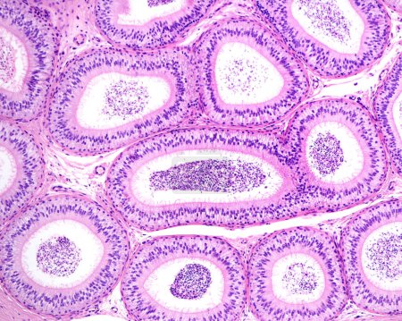 Conductos epidídimicos recubiertos por epitelio pseudoestratificado con células principales columnares altas que muestran estereocilia y células basales. La función del epidídimo es el almacenamiento, maduración y transporte de espermatozoides. Durante su tránsito en el epidídimo, 