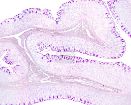 Sehr geringe Vergrößerung Licht Mikrographie der Magenwand mit PAS-Methode gefärbt. Die innere Schicht ist die Schleimhaut, die viele Falten aufweist. In der Achse dieser Falten befindet sich die Subschleimhaut. In der Schleimhaut, dem Schleimhautepithel und den foveolären Zellen der 