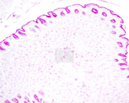 Microscopio de luz de la mucosa gástrica teñido con el método PAS. El epitelio de superficie mucosa y las células foveolares de los pozos gástricos muestran una gran positividad PAS porque son células de tipo mucoso.