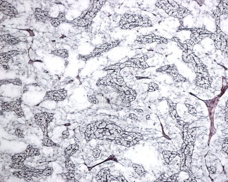 Light micrograph of a lymph node medulla stained with a silver technique for reticular fibres. The reticular network of medullary cord can be seen. The clear areas between medullary cords are the medullary sinuses.