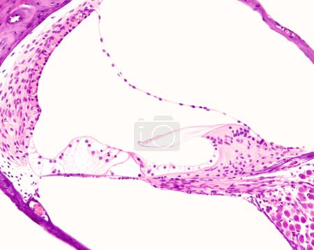 Micrografía ligera de una sección transversal de la cóclea del oído interno que muestra de arriba a abajo: conductos vestibulares, cocleares y timpánicos o escalones, separados por membrana Reissner y membrana basilar. El conducto coclear muestra, de derecha a izquierda, el s