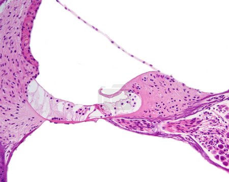 Lichtmikroskopische Aufnahme eines Querschnitts der Cochlea scala media oder des Cochlearkanals von rechts nach links: Limbus spiralis mit tektorialer Membran und Reissner-Membran, Organ Corti mit Tunnel von Corti und Haarzellen und Stria vascularis.