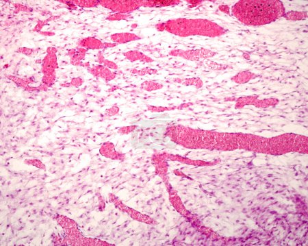 Vaskulogenese in einem Rattenembryo. Im mesenchymalen Bindegewebe entwickeln sich große Blutgefäße, die nur von Endothel gesäumt und voller Blutzellen sind.