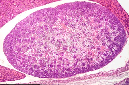 El desarrollo de riñón de un embrión de rata que muestra desde el exterior hacia el interior, una corteza renal con una zona nefrogénica hipercelular periférica, desarrollo de glomérulos en fase S y glomérulos ya con una cápsula Bowman. En el centro, hay un riñón inmaduro 