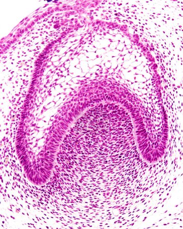Leichte Mikrographie eines sich entwickelnden Zahnes im Glockenstadium der Odontogenese. Der Zahnkeim, der noch mit dem Oberflächenepithel verbunden ist, zeigt von unten nach oben: Zahnpapille, Schmelzorgan mit Schmelzepithel, Stratum intermedium und Stellatennetzwerk
