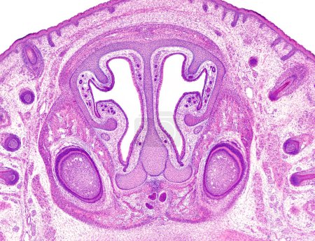 Coupe frontale d'une tête d'embryon de rat montrant les cavités nasales avec turbinats, septum nasal et épithélium olfactif. Deux germes dentaires (stade du chapeau) peuvent être observés dans les maxillaires en développement. Développer des bulbes capillaires peut être vu sous la peau