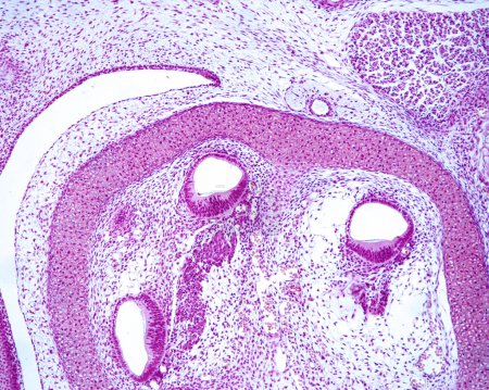Lichtmikroskopische Mikrographie, die drei Abschnitte einer sich entwickelnden Cochlea zeigt, wo man bereits die epitheliale Verdickung erkennen kann, die das Organ von Corti und das zukünftige Spiralganglion sein wird. Das knöcherne Labyrinth des Schläfenknochens befindet sich noch in Karti