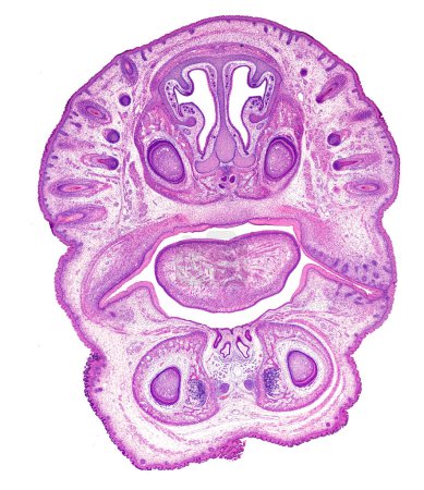 Foto de Micrografía de muy bajo aumento de una sección frontal de la cabeza de un embrión que muestra, de arriba a abajo, la piel con bulbos pilosos en desarrollo, cavidades nasales con los turbinados, tabique nasal y el órgano vomeronasal o Jacobson, dos gérmenes dentales, un - Imagen libre de derechos