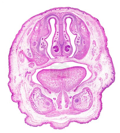 Foto de Micrografía de muy bajo aumento de una sección frontal de la cabeza de un embrión que muestra, de arriba a abajo, cavidades nasales con los turbinados, el tabique nasal y el órgano vomeronasal o Jacobson, y la cavidad oral con la lengua en el medio y - Imagen libre de derechos