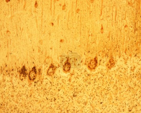 Cortex cérébelleux. Les cellules de Purkinje sont quelques-uns des plus grands neurones du cerveau humain. Ils sont situés à l'intérieur de la couche de Purkinje dans le cortex cérébelleux. La micrographie montre le grand appareil Golgi de ces cellules colorées avec le formol-u de Cajal.