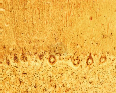 Corteza cerebelosa. Las células de Purkinje son algunas de las neuronas más grandes del cerebro humano. Se encuentran dentro de la capa de Purkinje en la corteza cerebelosa. El micrografo muestra el gran aparato Golgi de estas células teñidas con el formol-u del Cajal