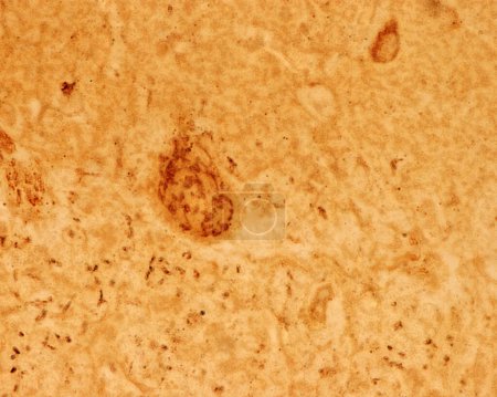 Großhirnrinde. Hochvergrößerte Mikrographie von Purkinje-Zellen, die mit der Formol-Uran-Silber-Methode des Cajal gefärbt wurden, um den großen Golgi-Apparat dieser Neuronen zu zeigen. Es erscheint als braunes Netzwerk, das sich im Soma der Purkinje-Zellen befindet. Die Gran