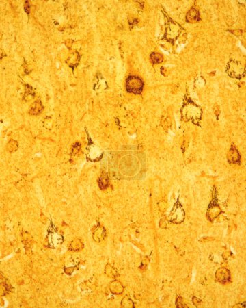 Pyramidenneuronen der Großhirnrinde, die den Golgi-Apparat zeigen, der mit der Formol-Uran-Silber-Methode des Cajal gefärbt wurde. Der Golgi-Apparat kann als schwarzes Netzwerk im Zellkörper pyramidenförmiger Neuronen gesehen werden, das den Kern umgibt, der
