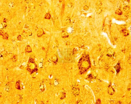 Pyramidenneuronen der Großhirnrinde, die den Golgi-Apparat zeigen, der mit der Formol-Uran-Silber-Methode des Cajal gefärbt wurde. Der Golgi-Apparat kann als schwarzes Netzwerk im Zellkörper pyramidenförmiger Neuronen gesehen werden, das den Kern umgibt, der