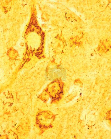 Mikrographie mit hoher Vergrößerung, die den Golgi-Apparat in den Betz-Zellen zeigt, den größten pyramidenförmigen Neuronen der motorischen Großhirnrinde. Der Golgi-Apparat erscheint als schwarzes Netzwerk, das sich im den Kern umgebenden Zellkörper befindet, und breitet sich auch aus.