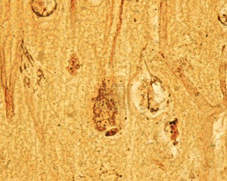 High magnification micrograph showing the Golgi apparatus in the Betz cells, the largest pyramidal neurons of the motor cerebral cortex. The Golgi apparatus appears as a black network located in the cell body surrounding the nucleus, and also spreadi