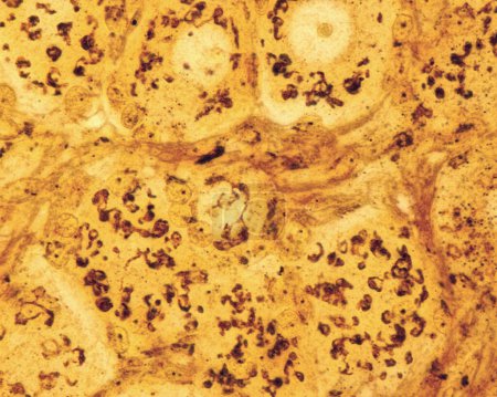 Light micrograph showing the Golgi apparatus in neurons of dorsal root ganglion. Cajal's formol-uranium silver method. The Golgi apparatus is distributed throughout the cell body cytoplasm around the nucleus.