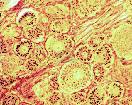 Micrographie photonique montrant l'appareil de Golgi dans les neurones du ganglion de la racine dorsale. La méthode formol-uranium argent de Cajal. L'appareil de Golgi est distribué dans tout le cytoplasme du corps cellulaire autour du noyau.