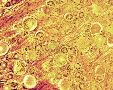 Lichtmikroskopmikroskopische Aufnahme eines dorsalen Wurzelganglions mit der Formol-Uran-Silber-Methode des Cajal, die den Golgi-Apparat in den dorsalen Wurzelganglion-Neuronen demonstriert. Der Golgi-Apparat ist im ganzen Land verteilt