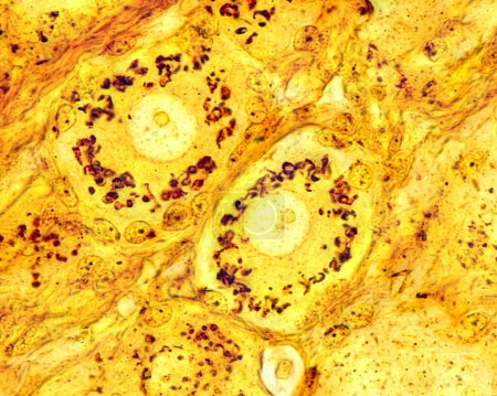 Foto de Micrografía de alto aumento de neuronas pseudounipolares de un ganglio radicular dorsal teñido con el método de plata formol-uranio del Cajal que demuestra el aparato Golgi. Aparece como una red marrón ubicada en el cuerpo de la célula neuronal alrededor del nu - Imagen libre de derechos